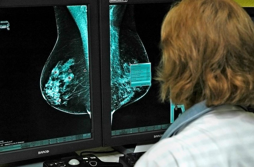 Mamografía tecnología 3D