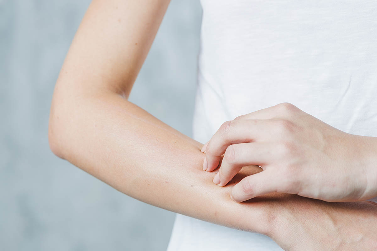 Dermatitis atópica y verano: Así es cómo te afecta y cómo puedes tratarla Dermatitis atópica y verano: Así es cómo te afecta y cómo puedes tratarla